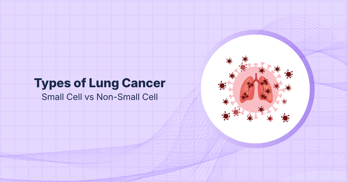 Types of Lung Cancer: Small Cell vs Non-Small Cell