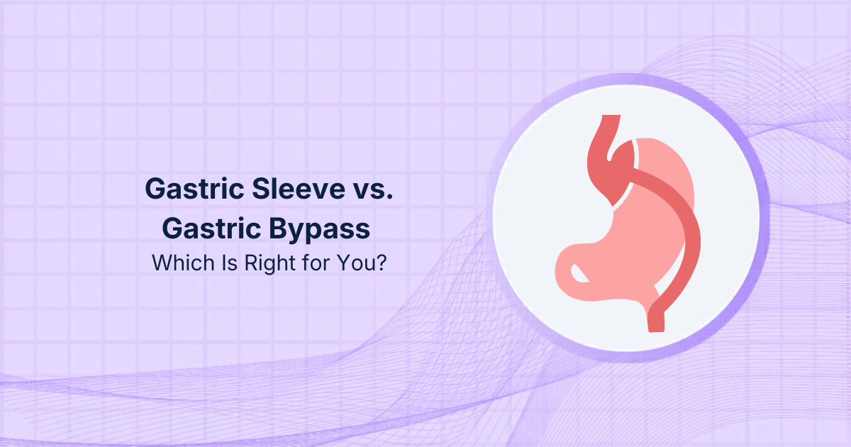 Gastric Sleeve vs. Gastric Bypass: Which Is Right for You?