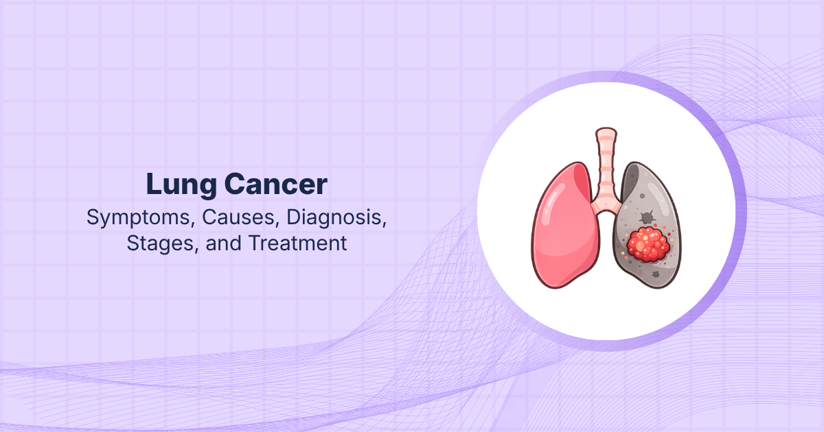 Lung Cancer: Symptoms, Causes, Diagnosis, Stages, and Treatment